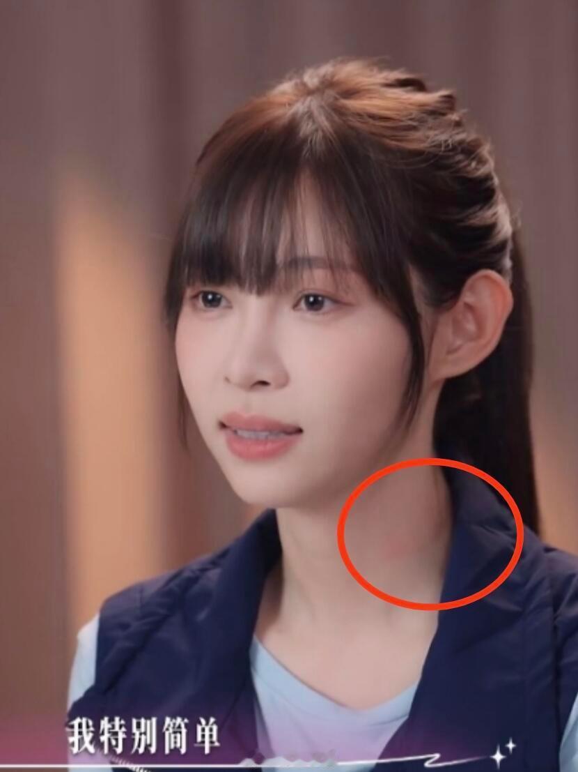 网友：痞幼脖子上是怎么了？