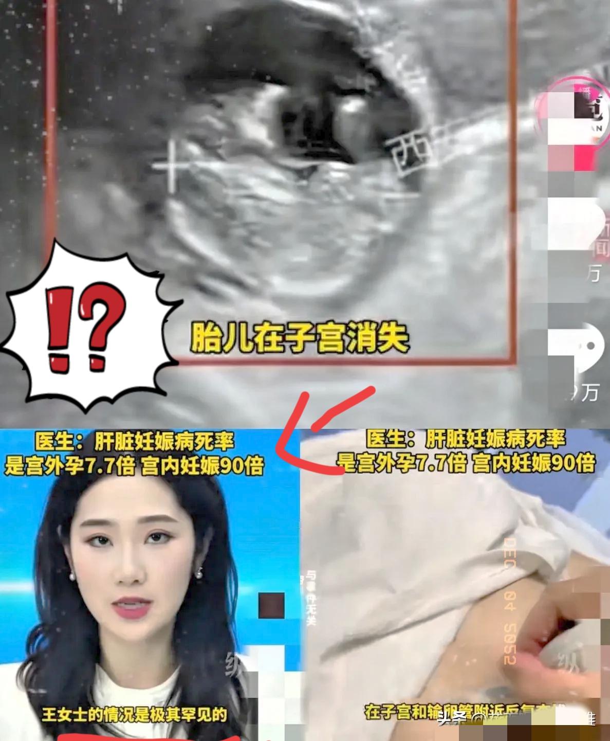 惊掉我下巴了！这事儿光是听着都后背发凉，生孩子真的是在闯生死关！西安40岁