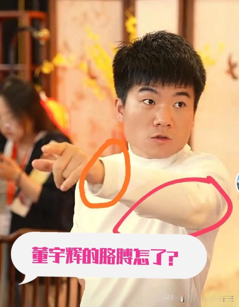 还是网友的观察能力强，发现董宇辉手破了，胳膊似乎有点不对劲。这已经董宇辉不是第