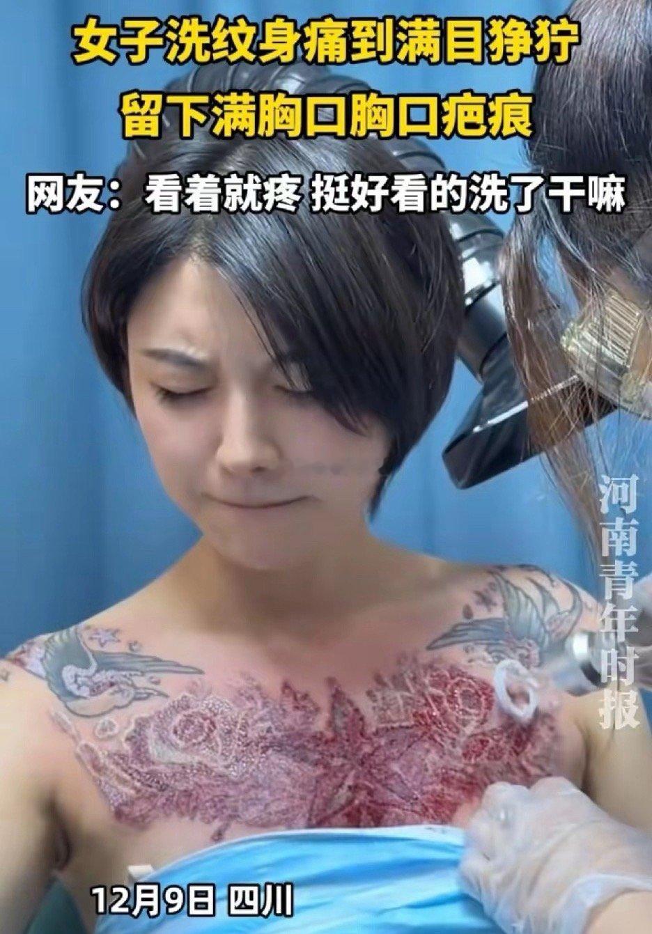四川一女子决定洗掉胸口大面积的纹身，痛得面目狰狞，最后留下满胸口的疤痕。都说纹身