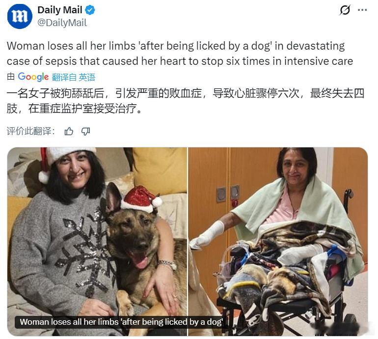 养宠物人士注意了！据《每日邮报》，英国一名女子因感染了极其严重的败血症（据信是被