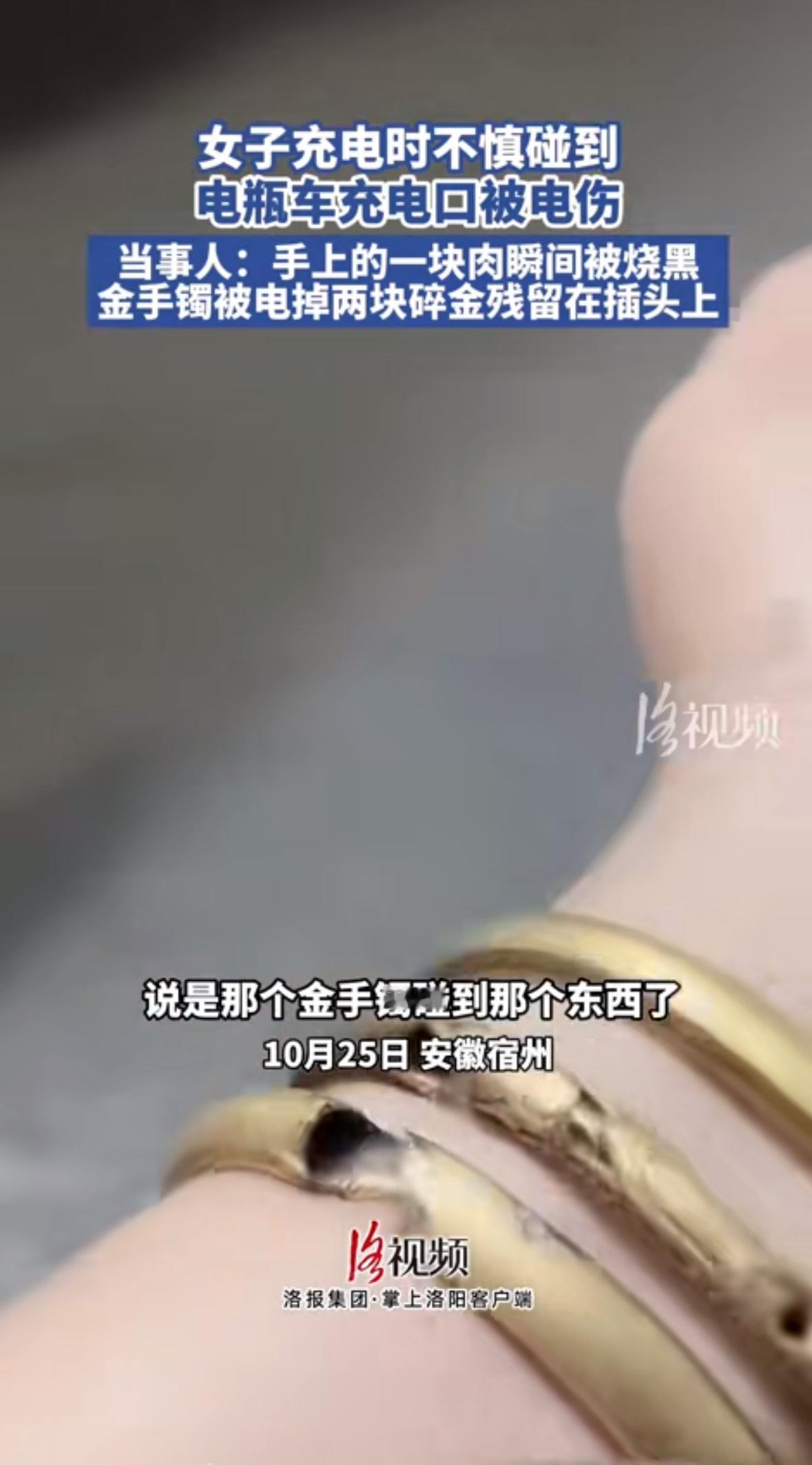 “就摸了一下充电口盖子，手上的肉直接烧黑了！”安徽宿州的刘女士怎么也没想到，自己
