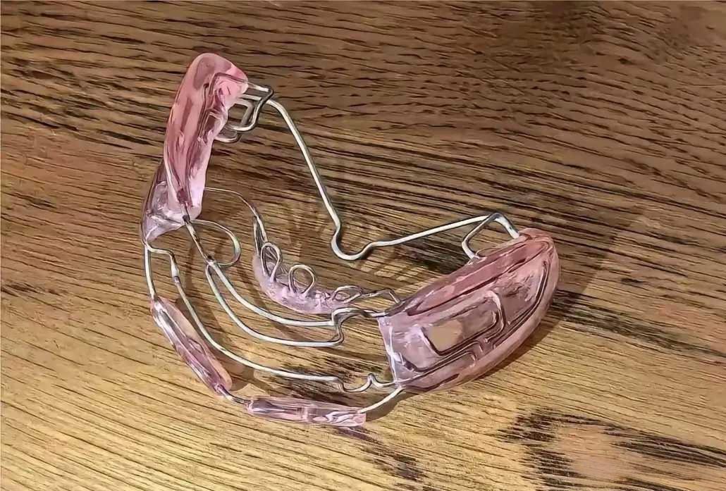 2000元，你们觉得值吗？