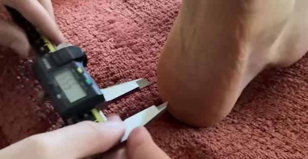 谁能想到不用抽血、不用做昂贵体检，一把卡尺就能测出你的真实生理年龄？很多人看完直