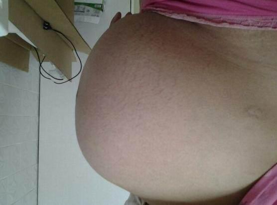 产妇肚子明明已经开始阵阵发动, 为什么肚子里的宝宝停了下来?