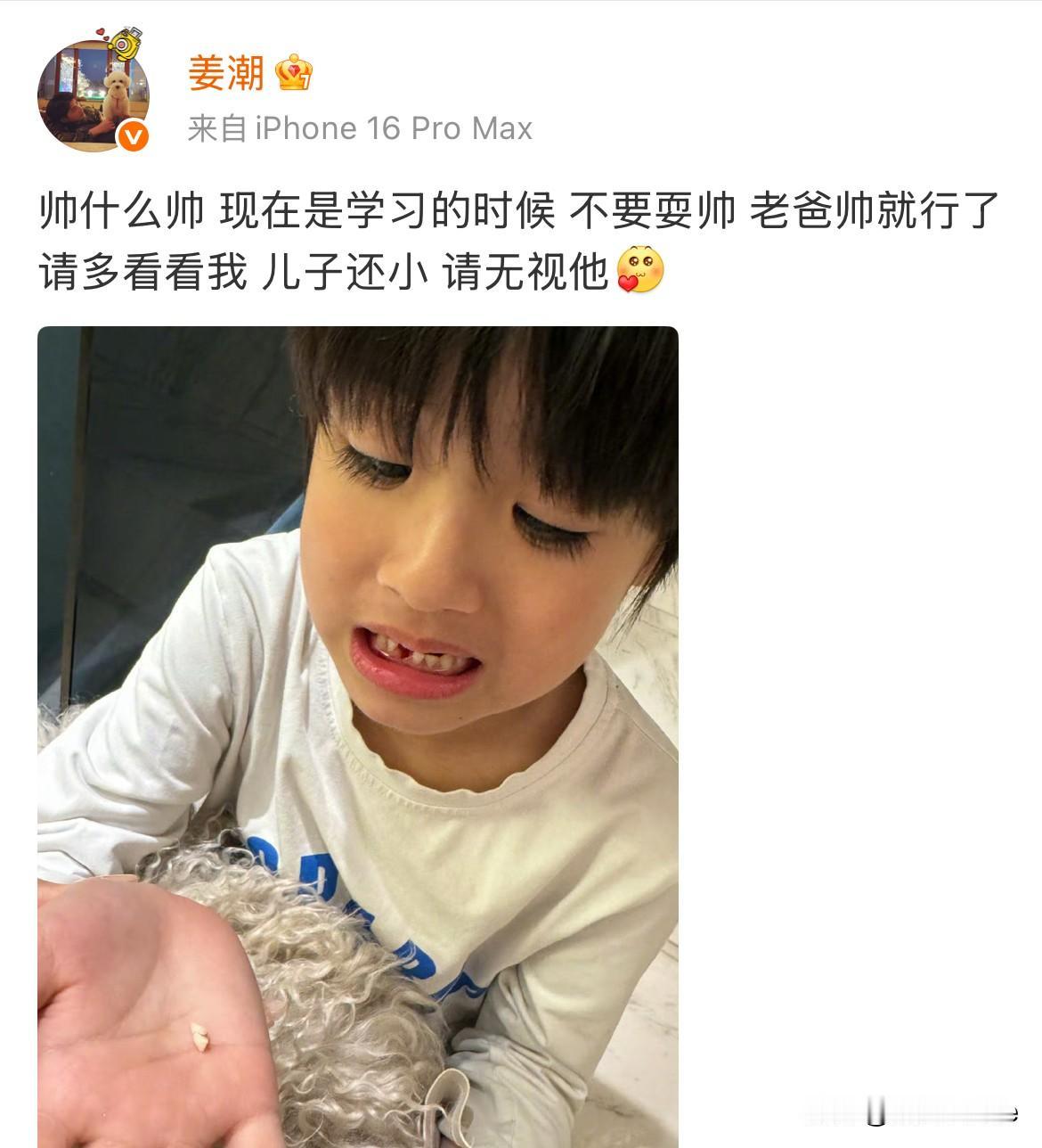 10月30日，姜潮呼吁网友无视他儿子！特意发儿子换牙“黑图”，明示孩子还小，有