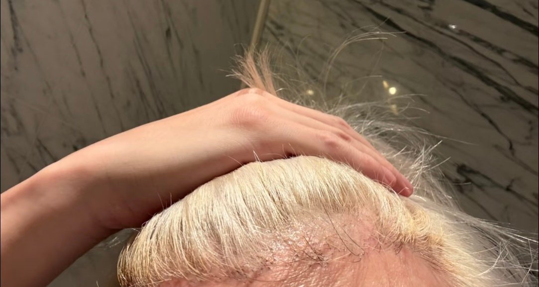 薛之谦斑秃原因薛之谦斑秃原因有了心疼老薛薛之谦