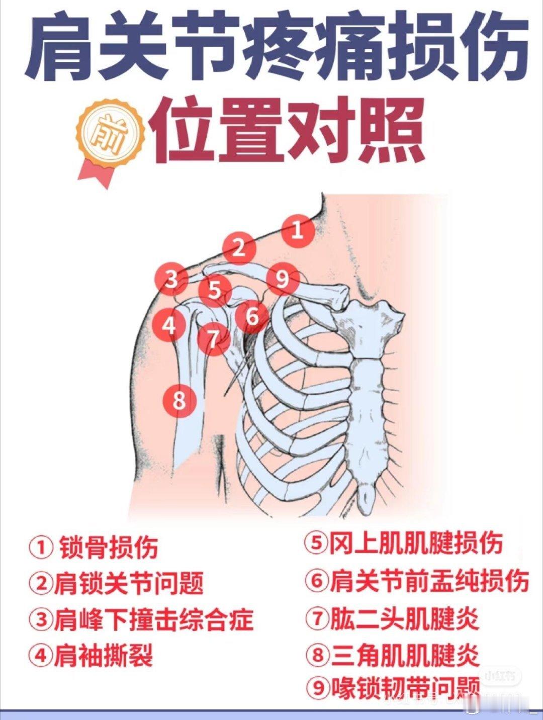 运动康复解决的困扰肩痛是什么原因？1️⃣A.滑囊炎（肩关节周围的滑囊炎症）常见