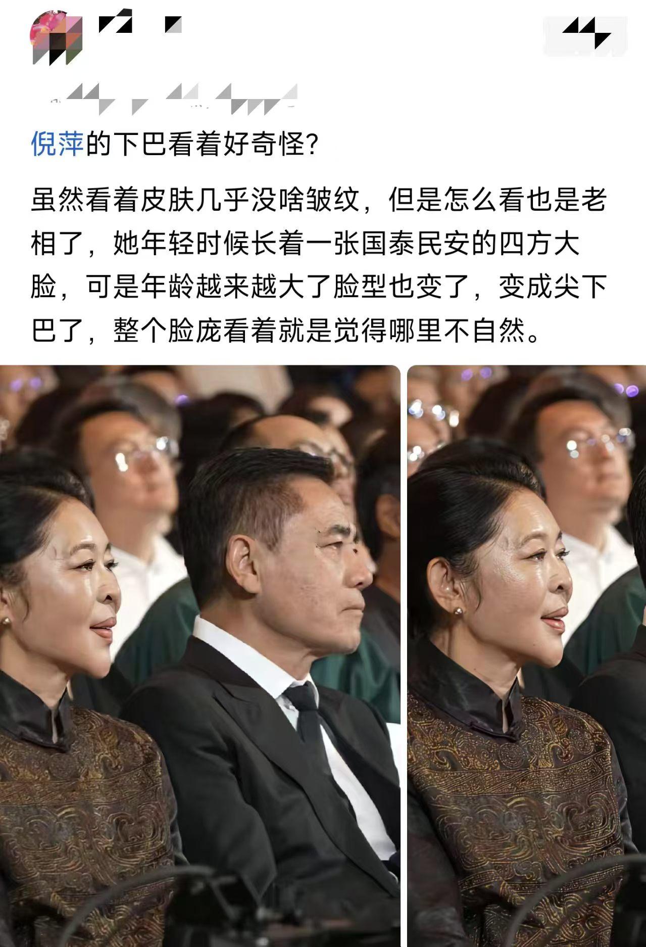 说句得罪人的话，这脸看着真不如满脸皱纹舒服。