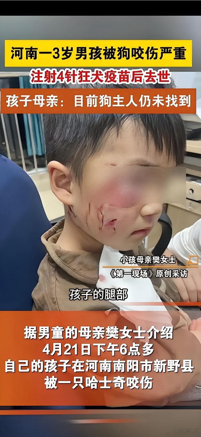 狂犬病百分之百的死亡率，无药可救，狗主监管不力，不给狗栓绳，任由狗跑出来吓人，无