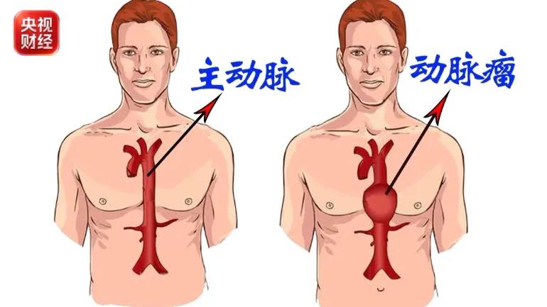 昨天深夜急诊科同事发来的真实案例，看得我心惊肉跳！一位40多岁的大哥，下班回