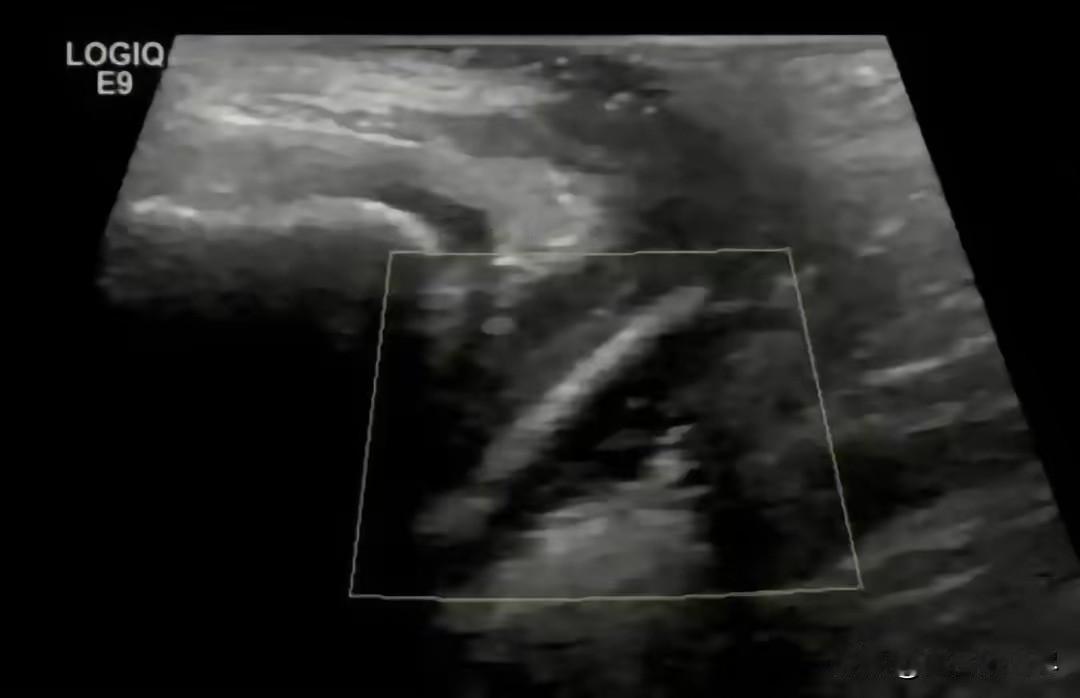 万万没想到！广东惠州，一名7岁女孩下体不舒服，妈妈一开始还没重视，以为抹抹药就好