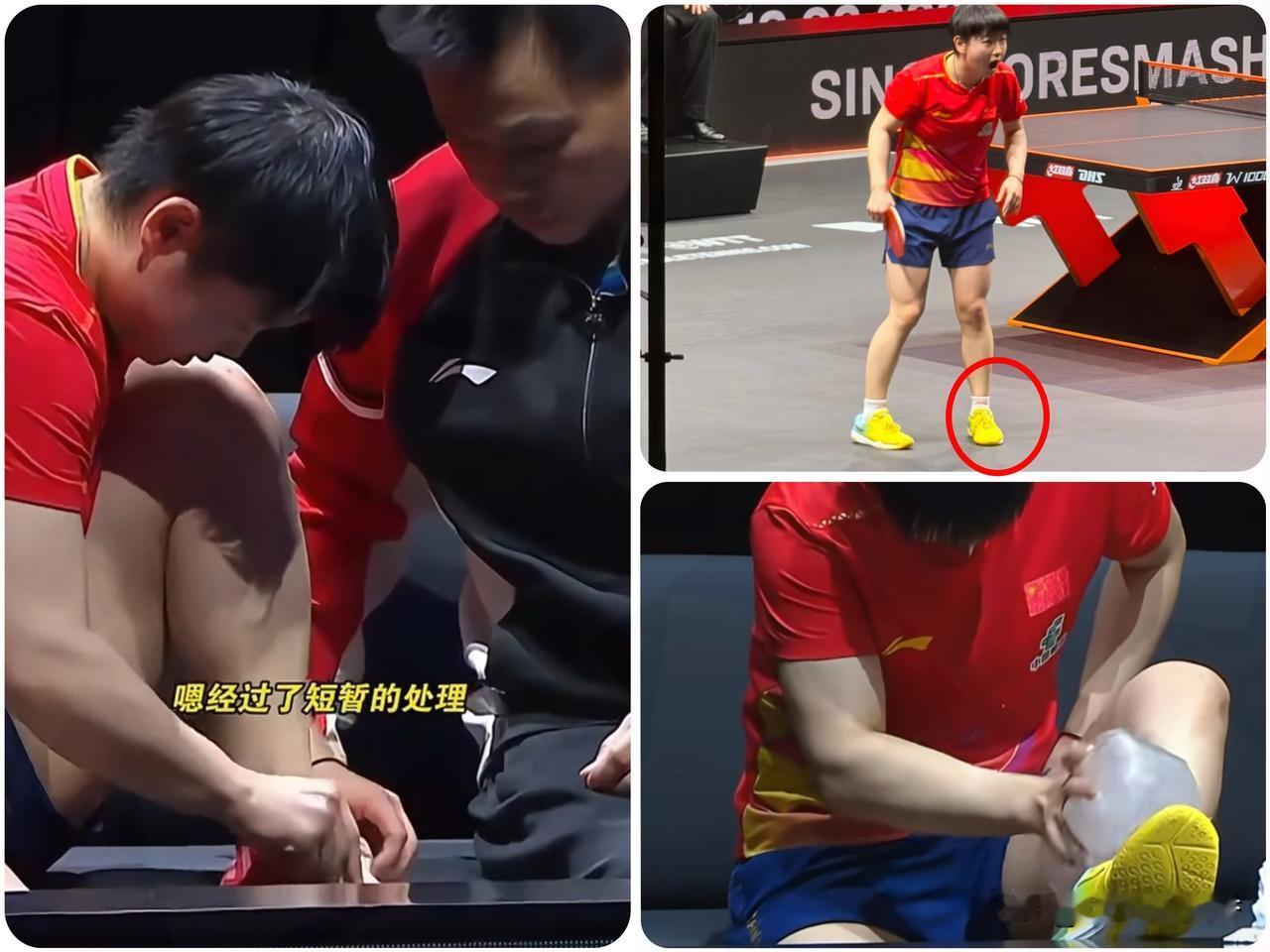 破防！孙颖莎脚伤缠绷带忍痛作战，比起队友，这两人的心疼藏不住了WTT香