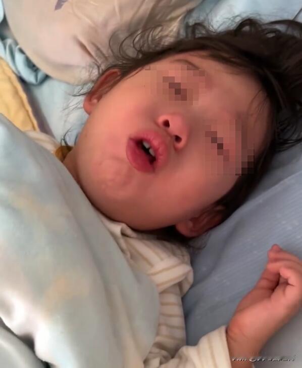 儿科医生说真话：孩子反复咳嗽，别因一时糊涂害了孩子。今天我的分享可能会得罪