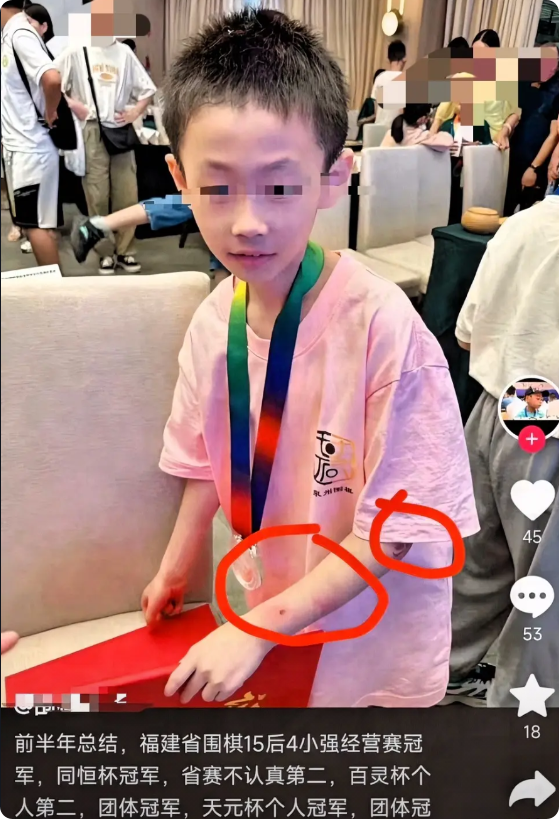 痛心，天才少年一跃而下！围棋天才朱宏鑫，19号晚上从楼上跳下，为什么这么