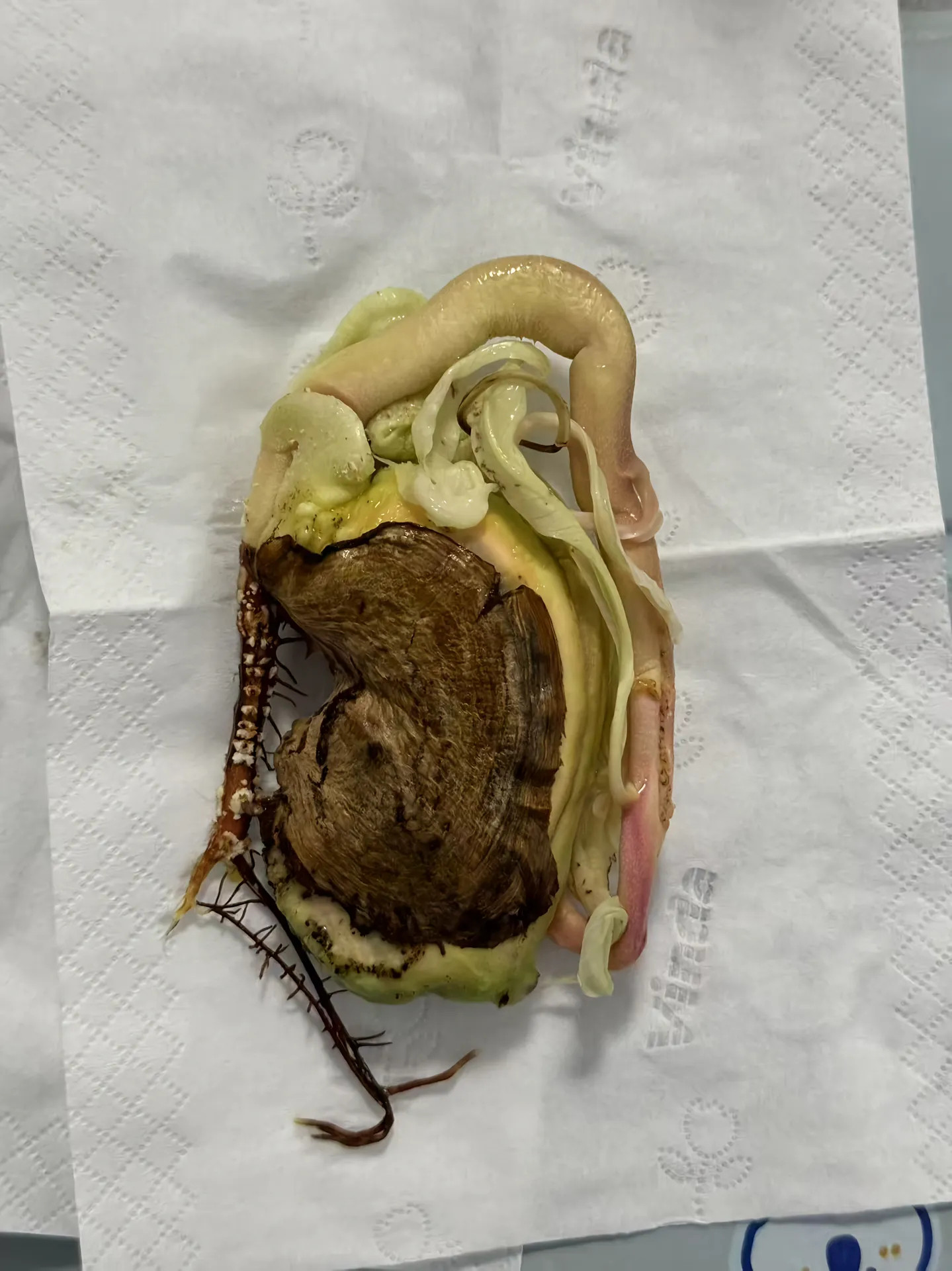 芒果核里面竟然是这样的当然也有不这么吓人的，比如图四这种，不过结构好像都差不多