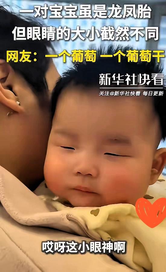 双胞胎“眼”趣，萌化人心科学解释不了的奇妙，在这对双胞胎身上尽显。他们因独特