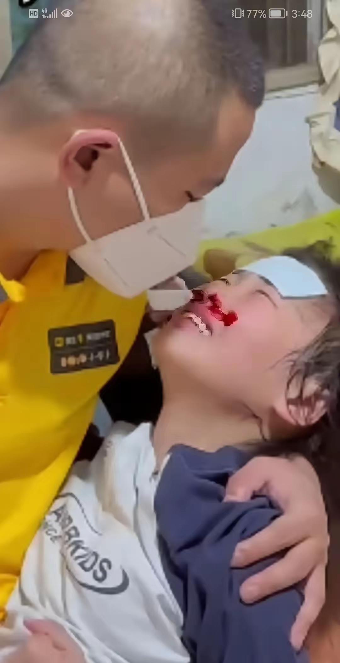 凌晨三点多，护士用手机拍下这对父女最后一张合影：粉色连衣裙的裙摆底下，藏着的却是