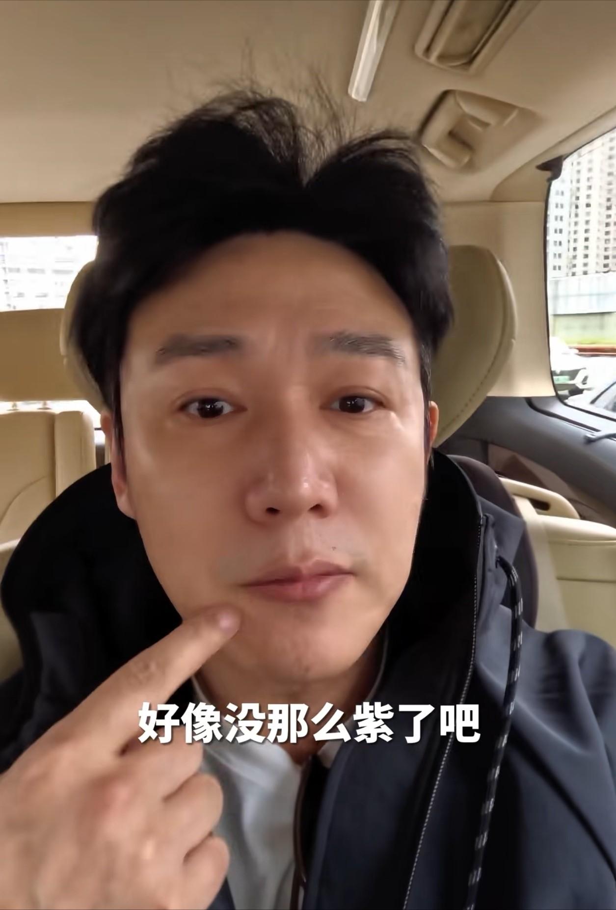 50岁的陆毅被网友“逼”进医院了，因为嘴唇发紫，粉丝一直在提醒去医院检查，让他确