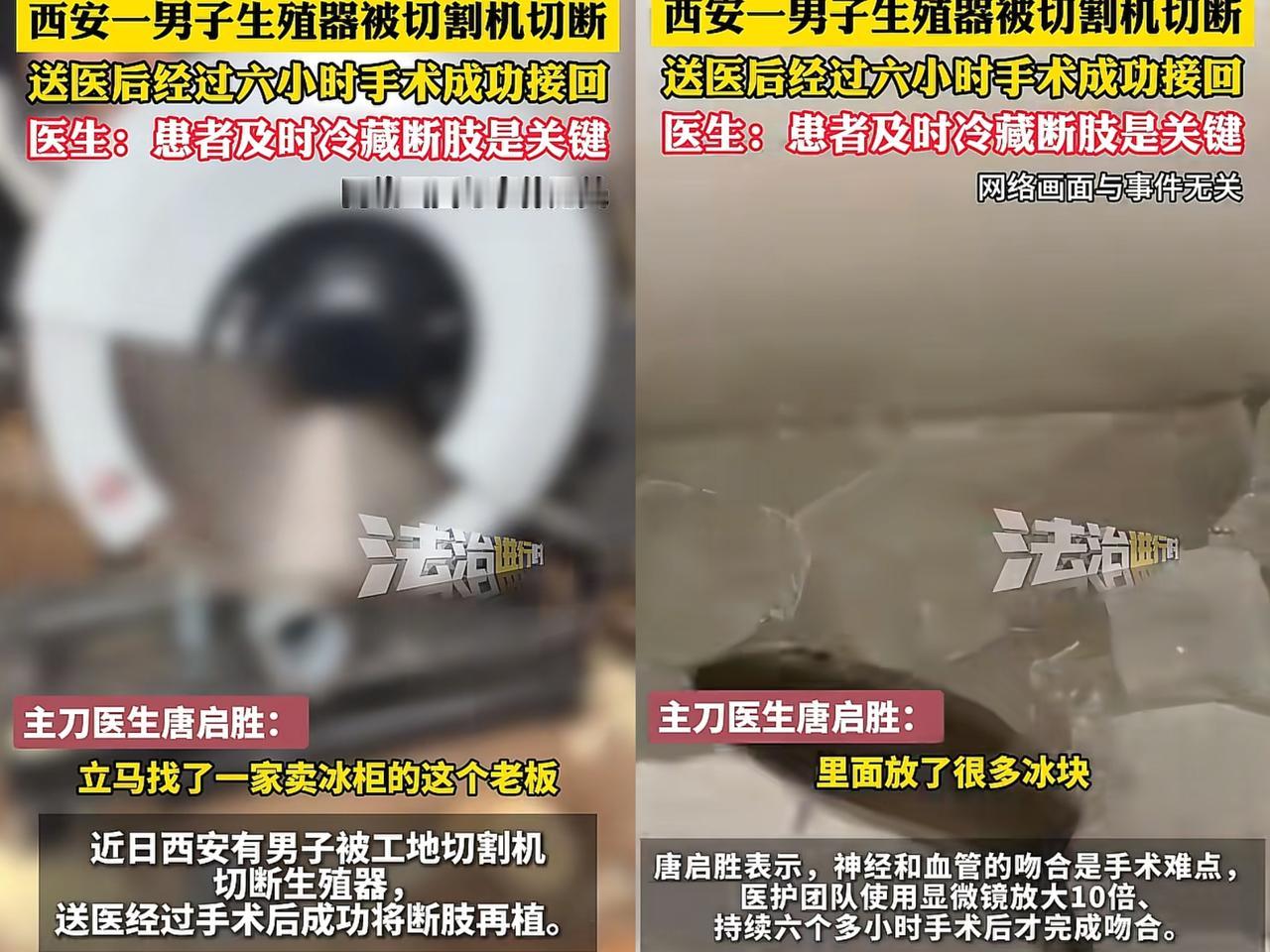 42岁钢筋工生殖器被切断，妻子冷静救回，术后3周排尿通畅工地上一不留神，