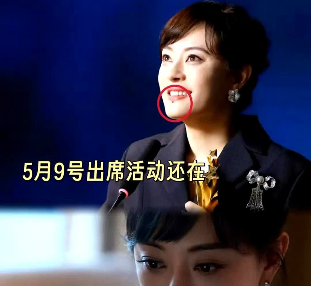 我怀疑孙俪把痣切了不是因为担心影响颜值，毕竟脖子上的扁平疣她都没管，很有