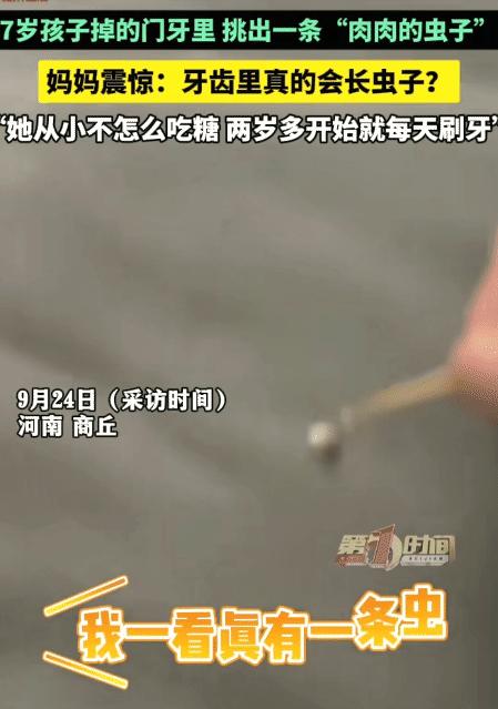 “太震惊了！”河南商丘，7岁孩子掉的门牙里。没想到，藏着“肉虫子”？孩子的妈妈挑