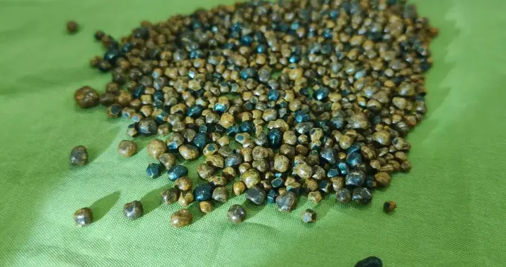 35岁男子两个月内胆囊长满1000颗结石，医生：已丧失基本功能