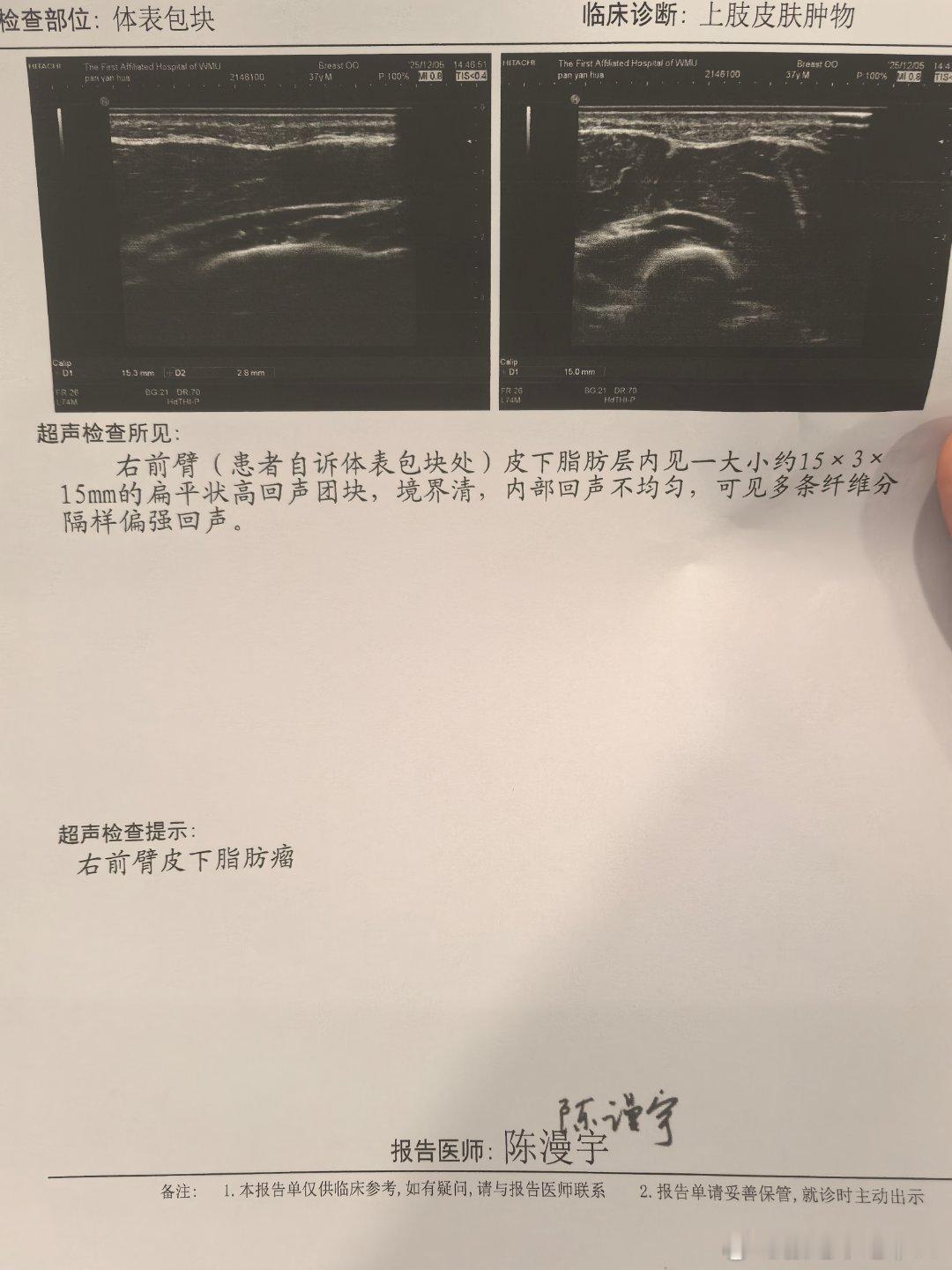 虽然一直知道是良性的脂肪瘤可是最近不知道锻炼的缘故还是变大了，突然感觉紧巴巴的。