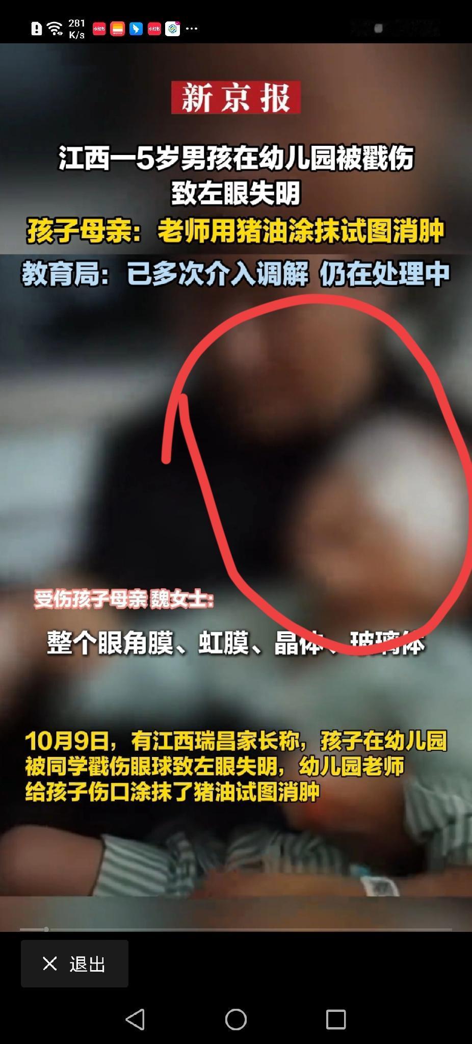 5岁娃左眼被戳瞎，老师竟抹猪油“救场”？江西家长怒了！“孩子哭着回来，我以
