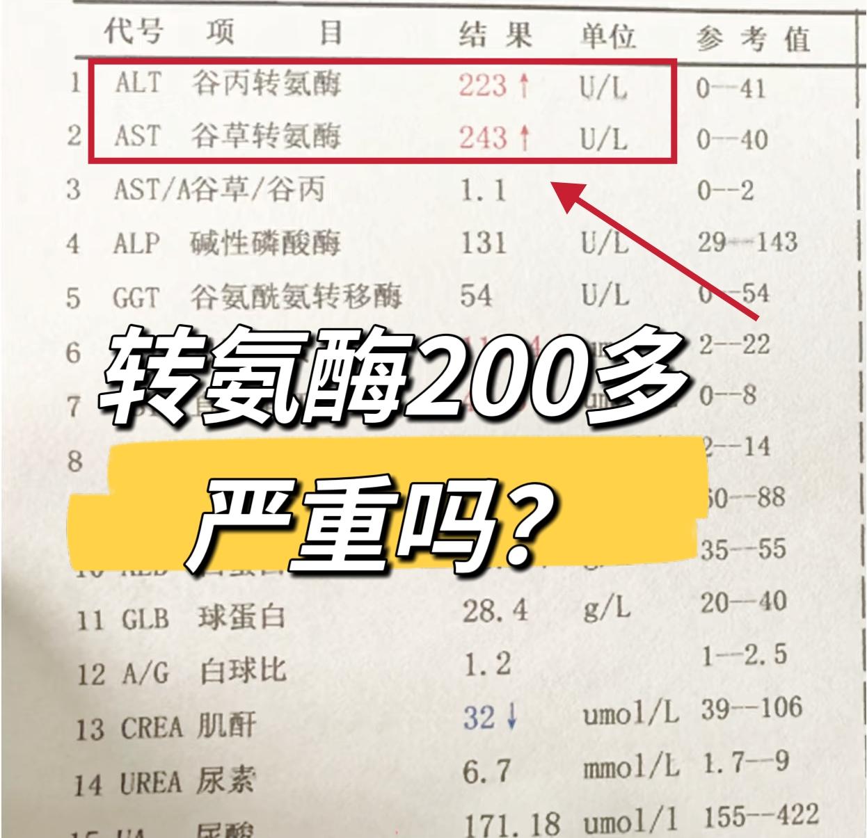 转氨酶200多严重吗？转氨酶正常情况下在0 ~40U/L，200多明显...