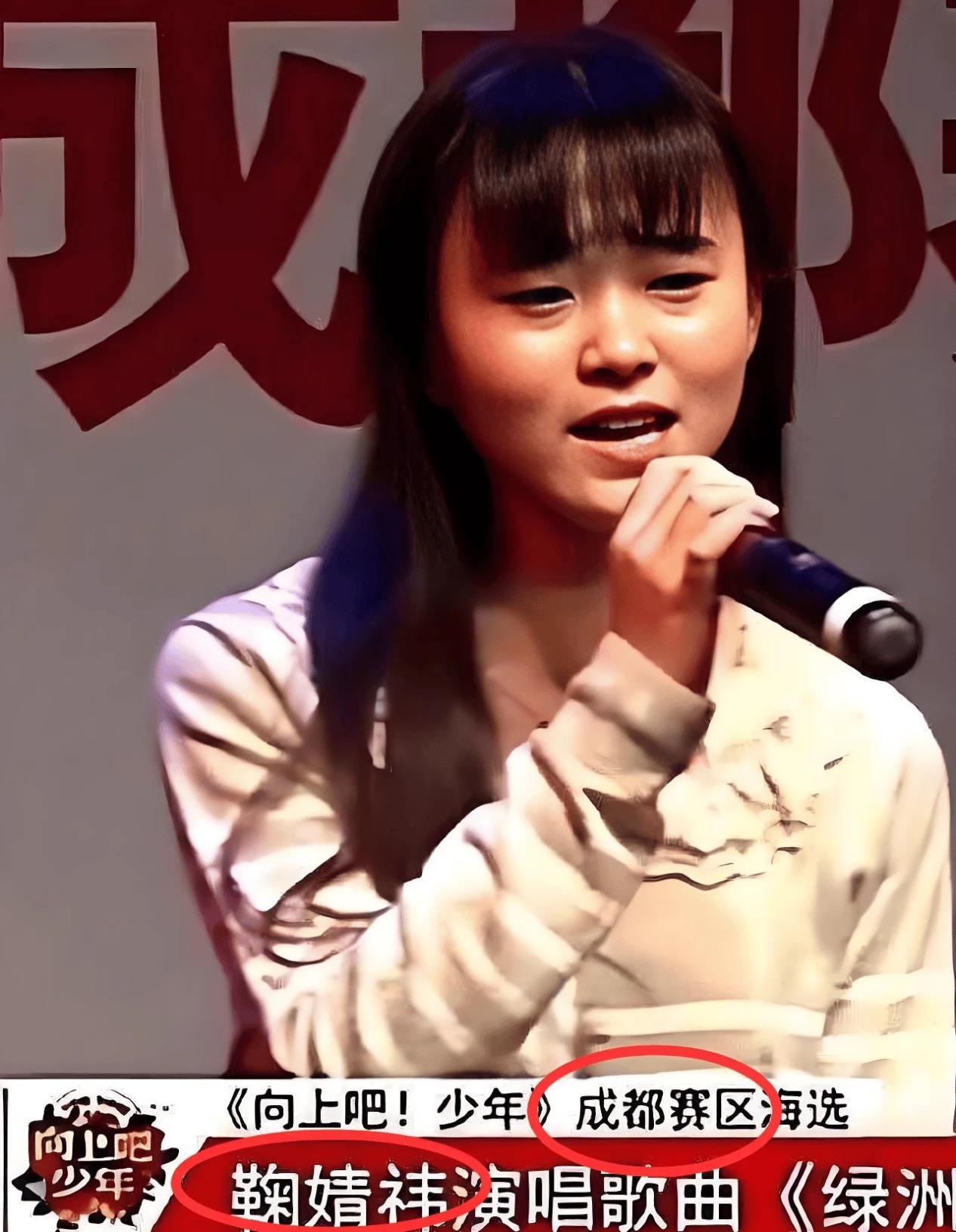 鞠婧祎的美商没得说：眼睛大了，眼皮双了，眼袋没了，颧骨平了，下颌角没了，鼻梁高了