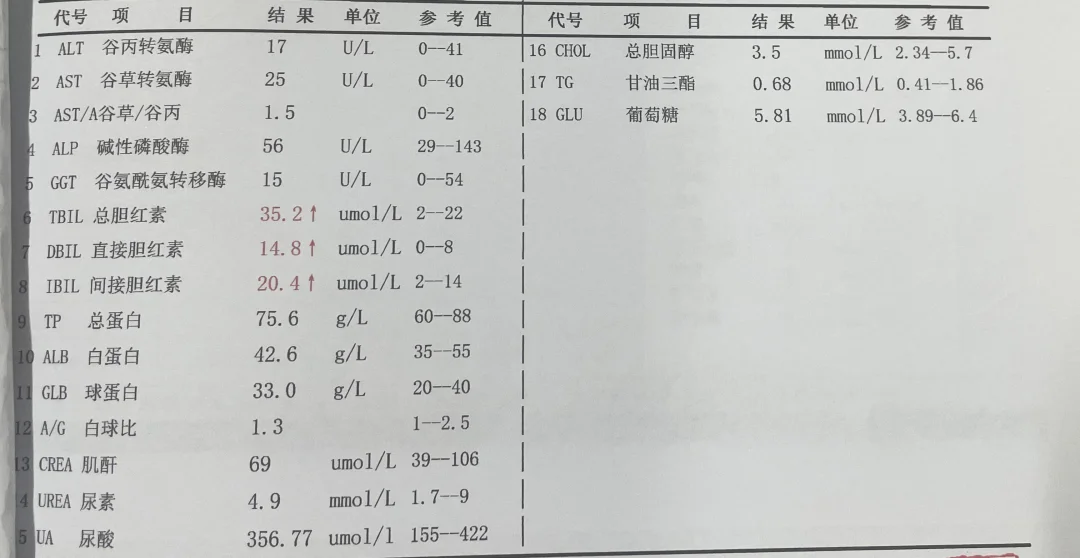 警惕肝细胞性黄疸！肝细胞受损，影响胆红素的摄取、结合和排泄，使血液中胆...