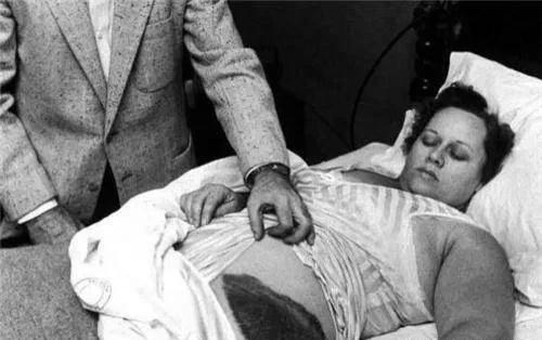 1954年，国外一女子正在睡觉中，突然感觉腹部和大腿被什么东西蹭着了一样，疼痛难