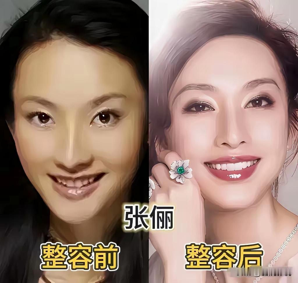这几个明星还可以吧，整容整的还挺成功，不过本来底子都很好，这样的调整只能算是微