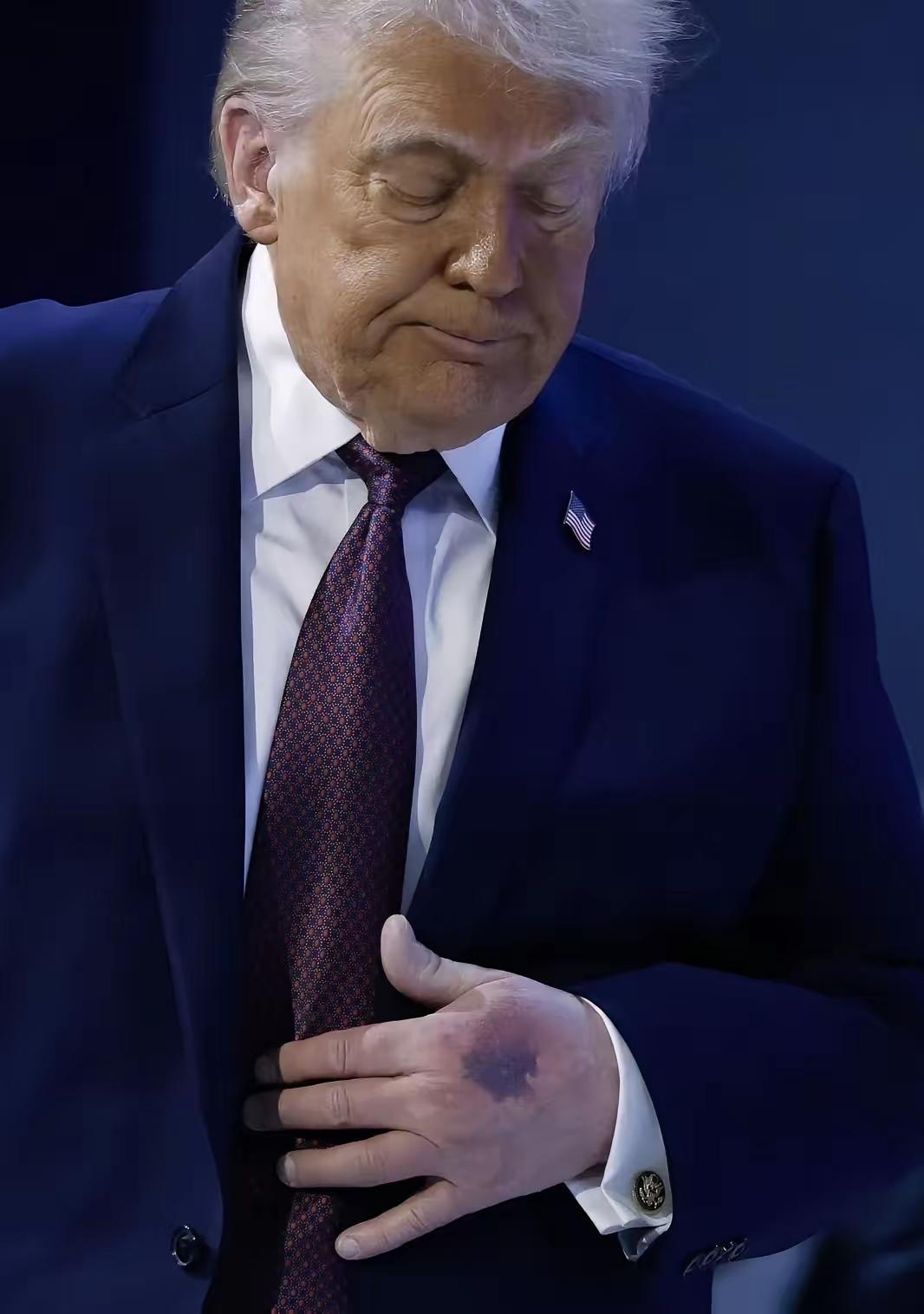 以色列要打伊朗，必须快一点。因为特朗普可能快不行了。现在美国各地都在抗议特朗普