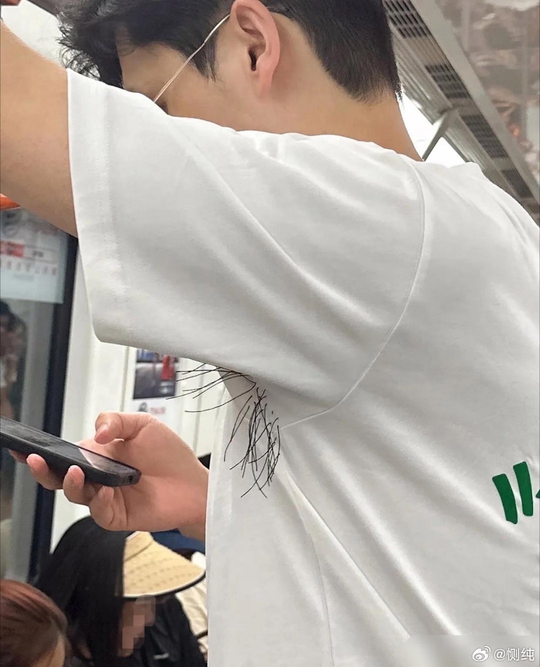 不懂就问，这衣服是设计的还是腋毛穿过了衣服？