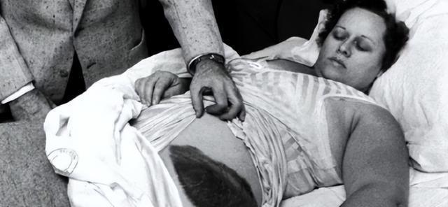 1954年，国外一女子正在睡觉中，突然感觉腹部和大腿被什么东西蹭着了一样，疼痛难