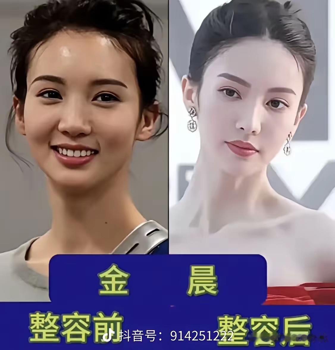 说这四个女明星整过容，我是不相信的。出出道，前后看起来没有什么变化嘛，你说微调的