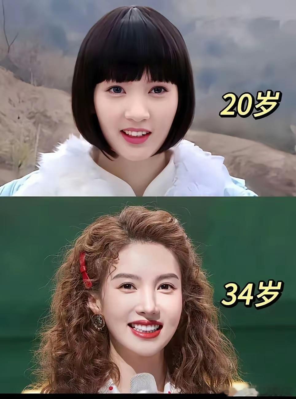 金晨在医美的路上越走越远！！