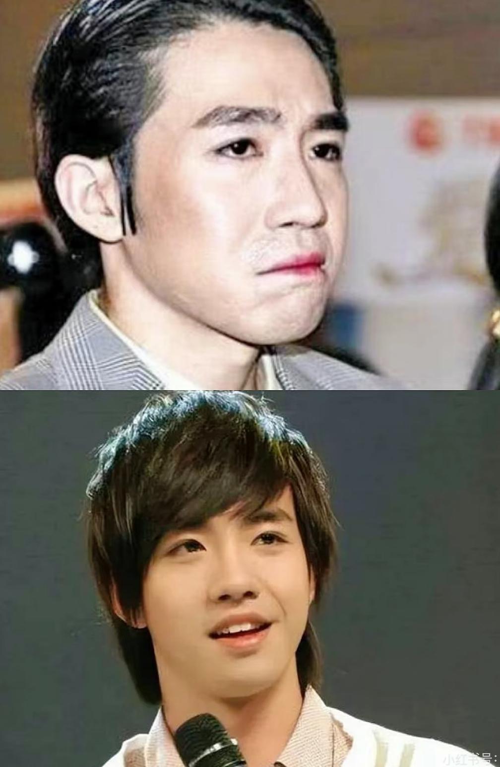 俞灏明这十五年，才是内娱最体面的逆风翻盘。大火毁容后被女友抛弃，他明明握着一