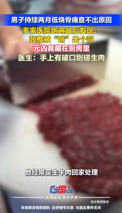 “这病真离谱！”7月21日报道，一男子持续两月低烧骨痛，跑了多家医院都没查到原因