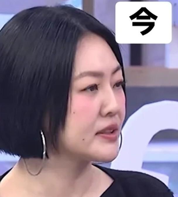 经纪人回应小S替身猜测据台媒，小S回归《小姐不熙娣》后，有网友发现脸上多了两颗