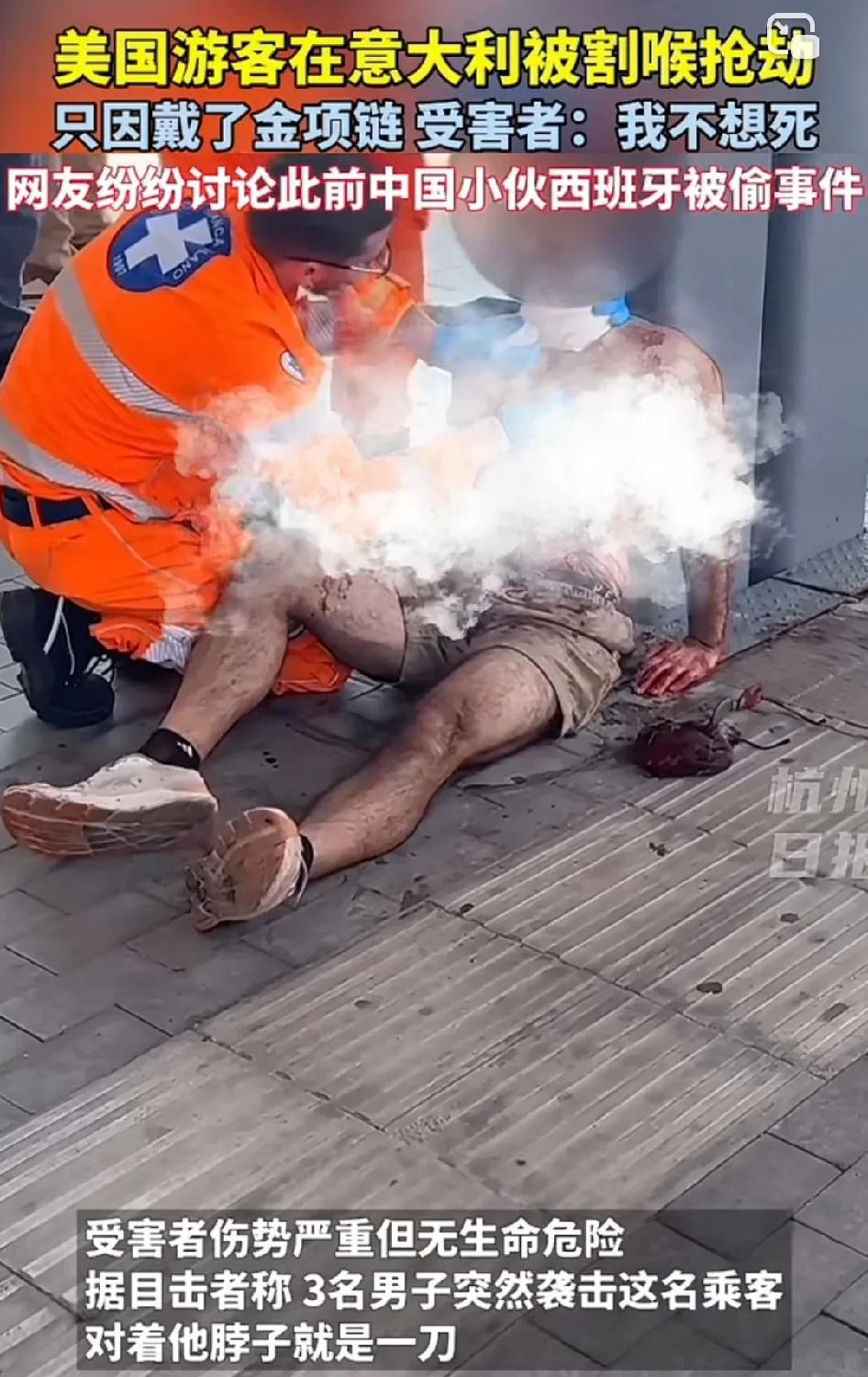 来欧洲旅游的尽量不要漏财，隐藏好证件钱财！美国游客在意大利被割喉抢劫只因戴了