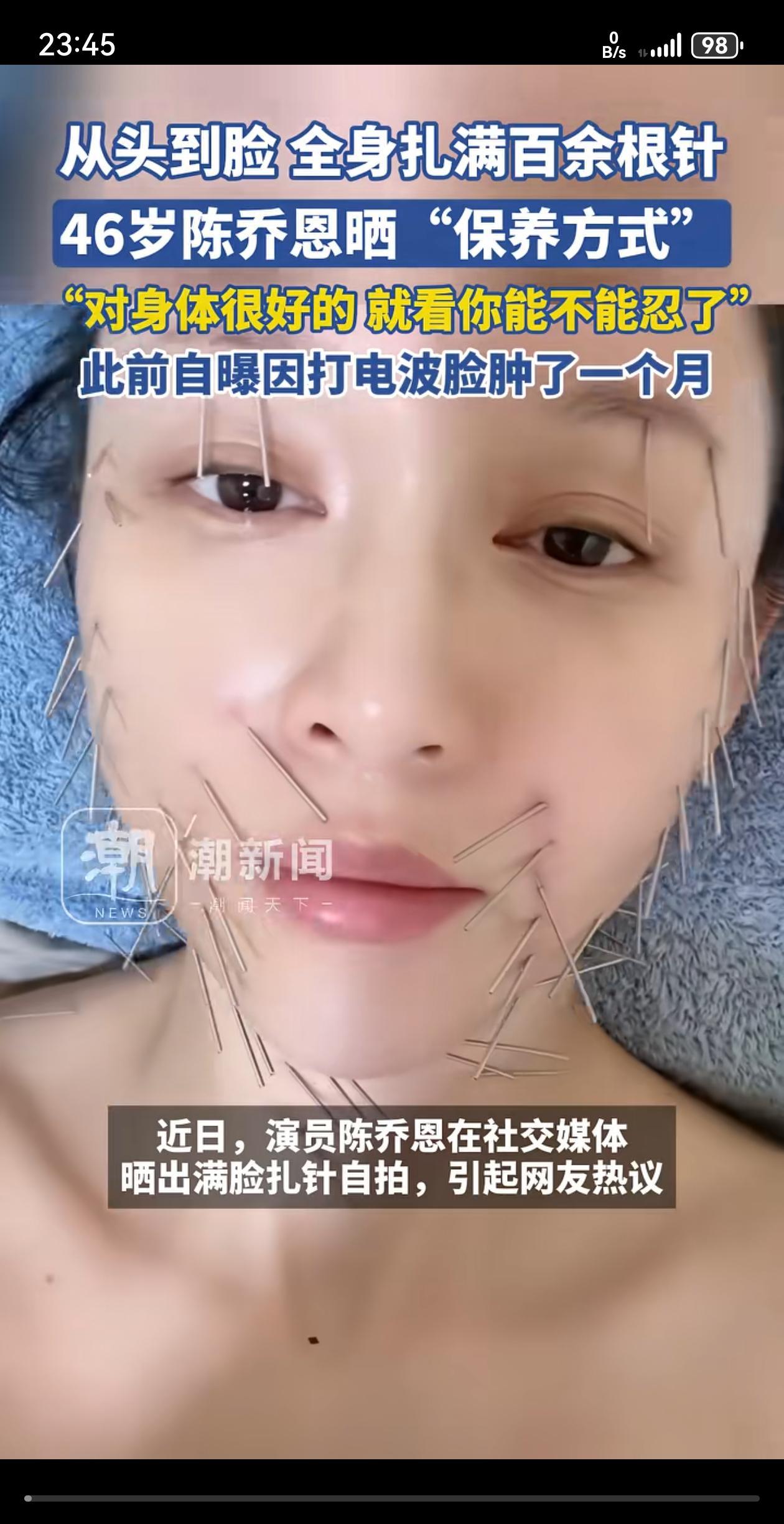 陈乔恩有针灸疗法达到美容养颜效果。女明星为了美丽真狠