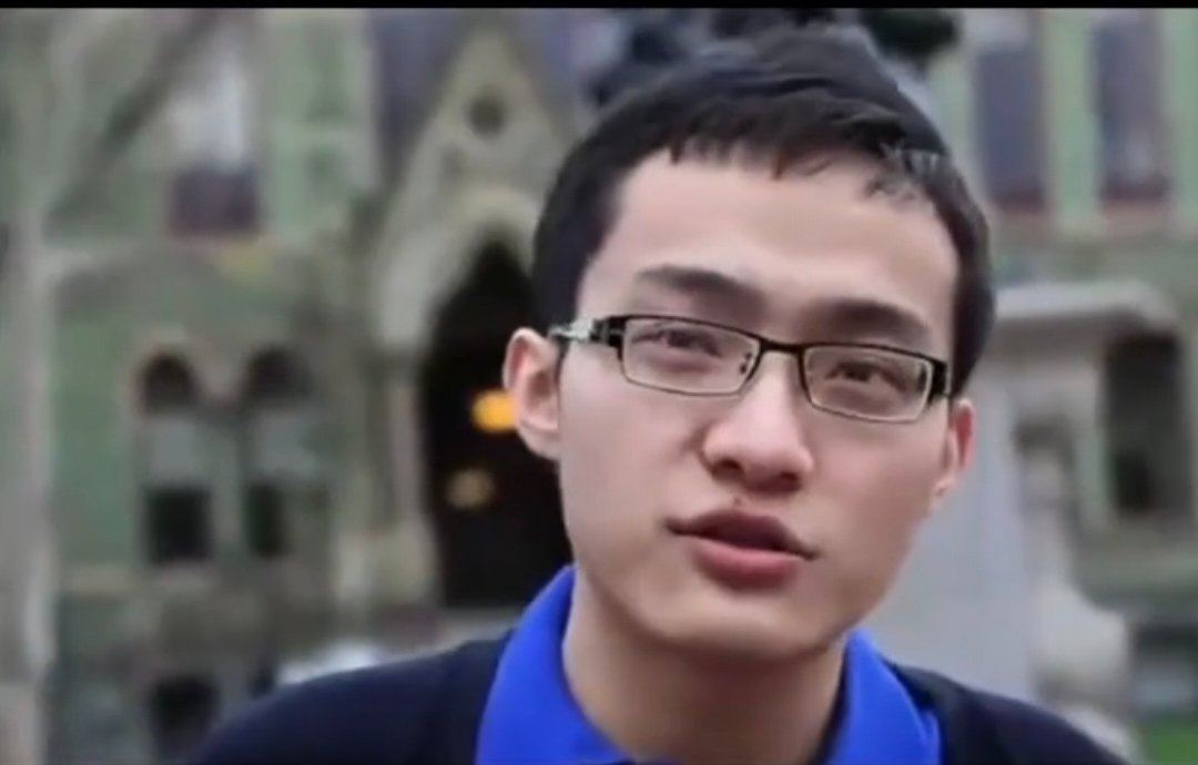 #这一步向平衡##国医的精诚力量#孙宇晨，印堂不宽，早年上唇痣点了，上唇痣就是口舌是非痣，男科也是有