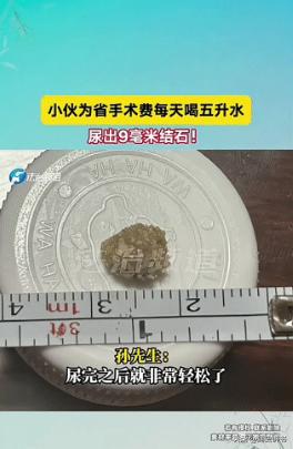 “这是个狠人！”2025年2月，上海，男子上班时突然腰部剧痛，去医院一查，发现双