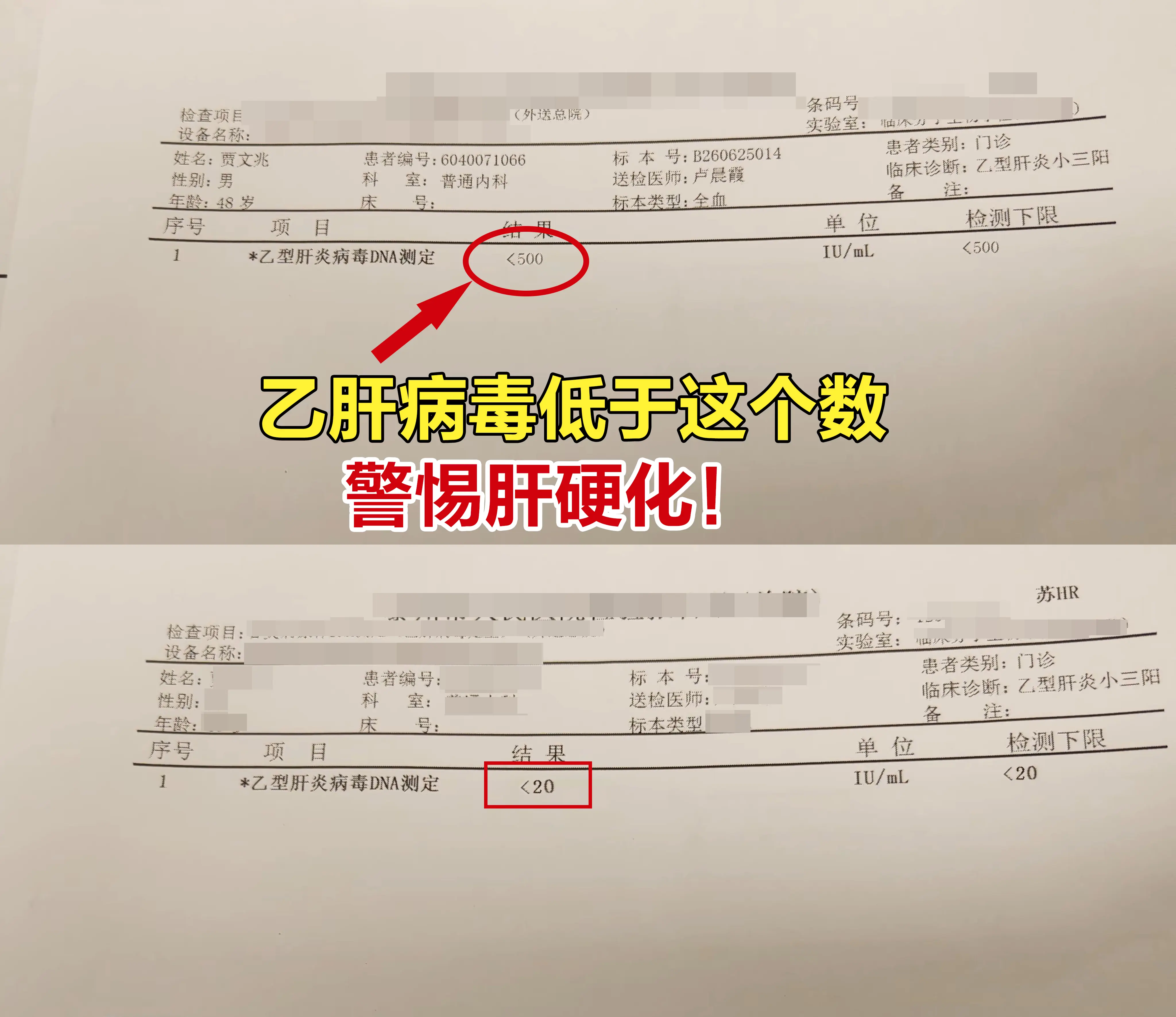 大家先不要着急着反驳，乙肝病毒量低于500，并不是终点，不少乙肝患者看...