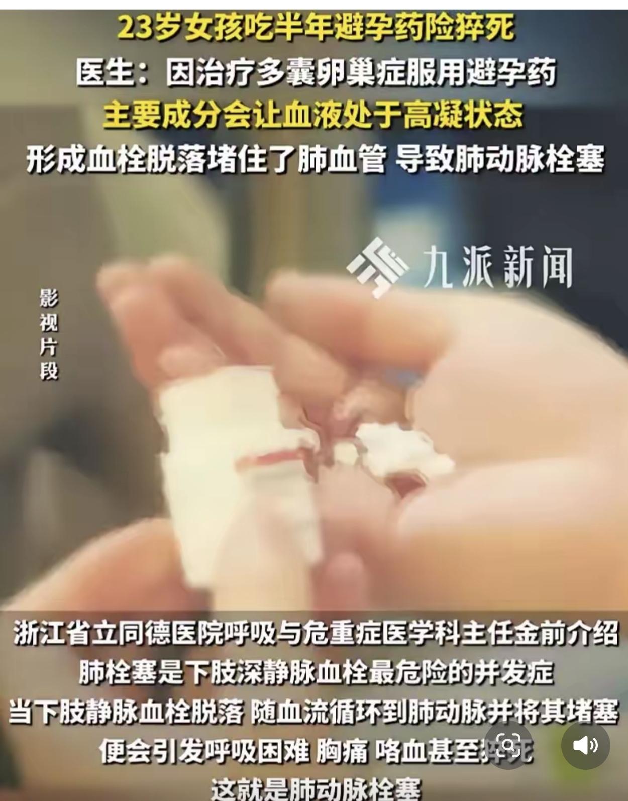 浙江杭州，一23岁女孩连续半年服用避孕药，没想到她有次身体不舒服，老是干咳，五