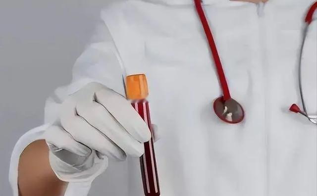 在日常生活中，许多人往往忽视了饮食对健康的影响，尤其是高血脂。无论你的体力如何强