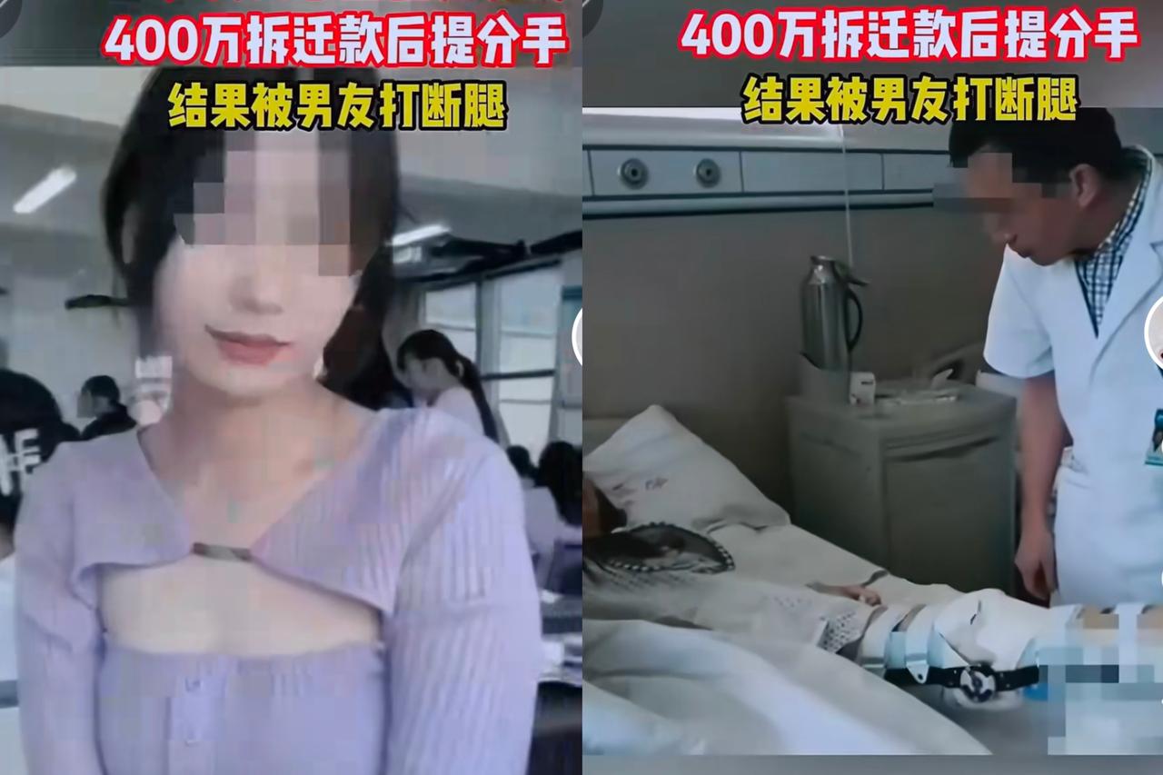 你敢信吗？19岁女大学生挥霍男友400万拆迁款后提分手，结果被男友打断腿！这事